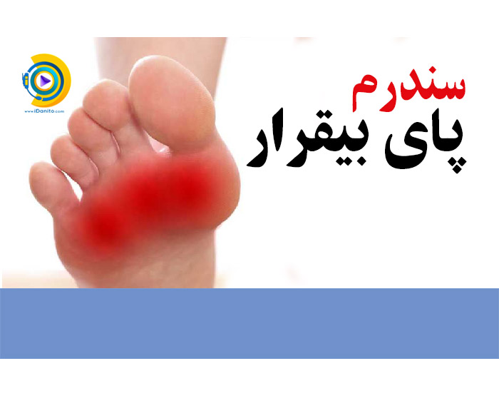 سندرم پای بیقرار